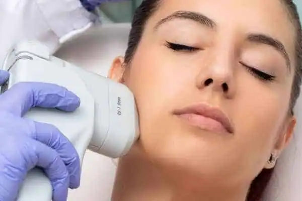 Image of woman having HIFU Ascot treatment