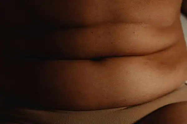 The Hidden Connection: How Stress Shapes Your Fitness and Body Composition 3 image of what stress can do on the stomach area and how Lipo 360 Ascot can help to change your body shape.