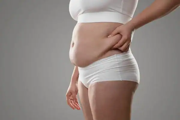 Image of stress belly Ascot How Lipo 360 can help manage your symptoms