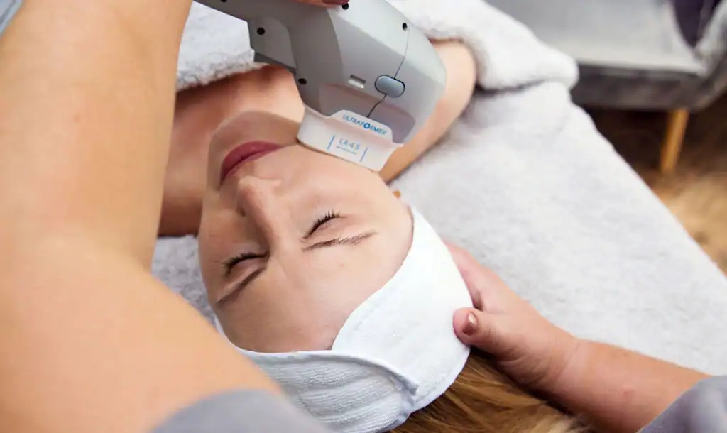 Discover the Perfect Duo: RF Microneedling and HIFU 1 Image of Morpheus8 And HIFU Ascot combined treatment